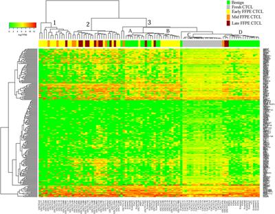 TruSeq-Based Gene Expression Analysis of Formalin-Fixed Paraffin-Embedded (FFPE) Cutaneous T-Cell Lymphoma Samples: Subgroup Analysis Results and Elucidation of Biases from FFPE Sample Processing on the TruSeq Platform